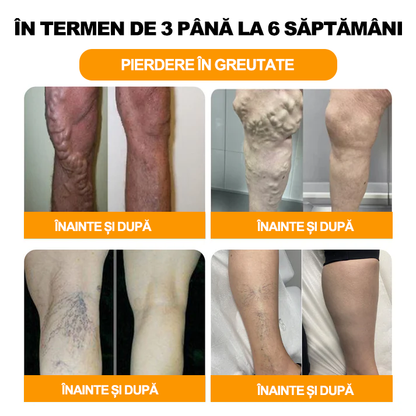 𝐀𝐞𝐞𝐡𝐟𝐞𝐧𝐠™ 30 Perle de baie pentru picioare pe bază de plante pentru slăbire și detoxifiere-❤️👩‍⚕️(Recomandat de Asociația Europeană de Limfologie (ELS））